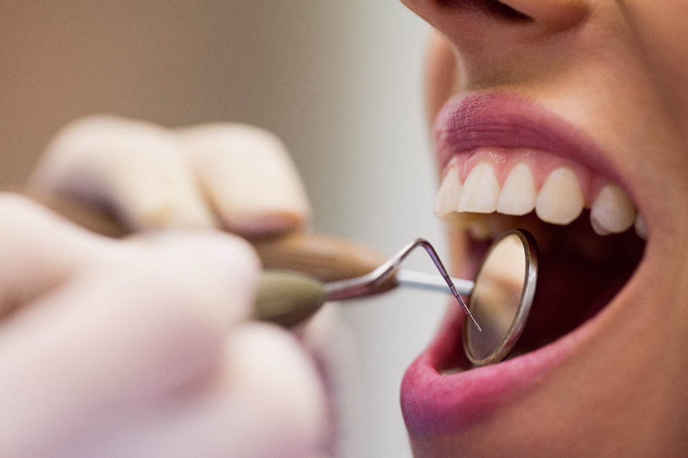 Professional dental hygiene in Rome Professional dental hygiene in Rome