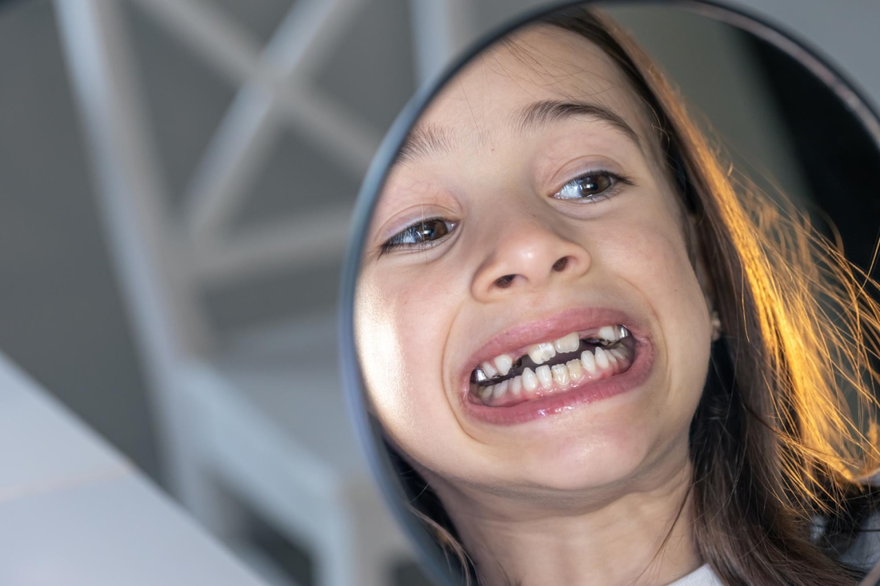 Orthodontics for children - Rome EUR Laurentina, Via Cesare Pavese