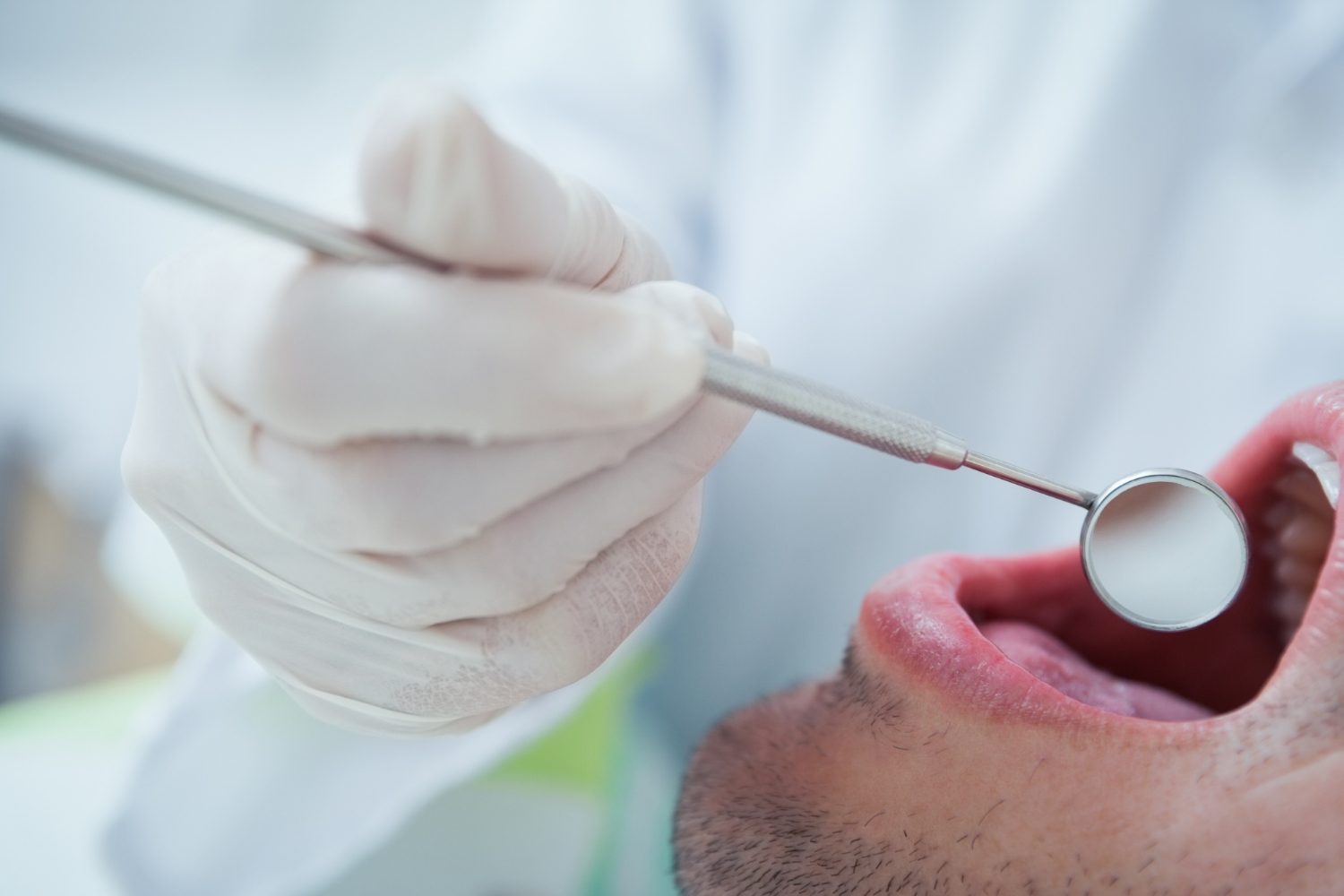 Dental tartar: how it forms and how it is removed