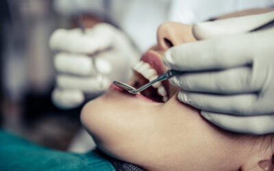 Parodontite (o piorrea): una patologia silenziosa e pericolosa