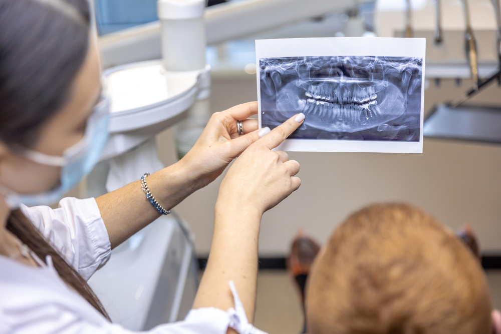Implantologia Dentale Roma EUR Laurentina