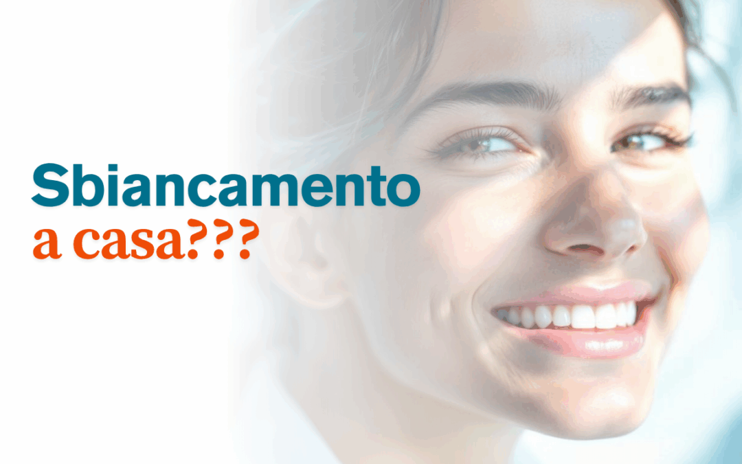 Posso sbiancare i denti a casa? Le risposte del dentista alle domande più frequenti
